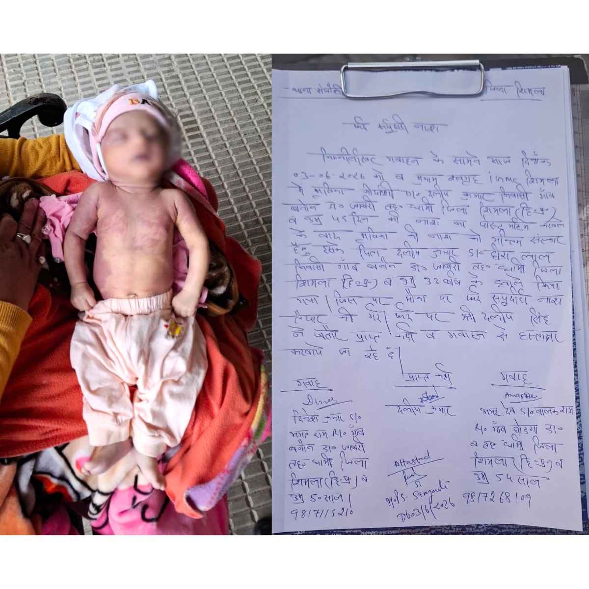 Baby Dies After Vaccination Shimla Case Under Probe